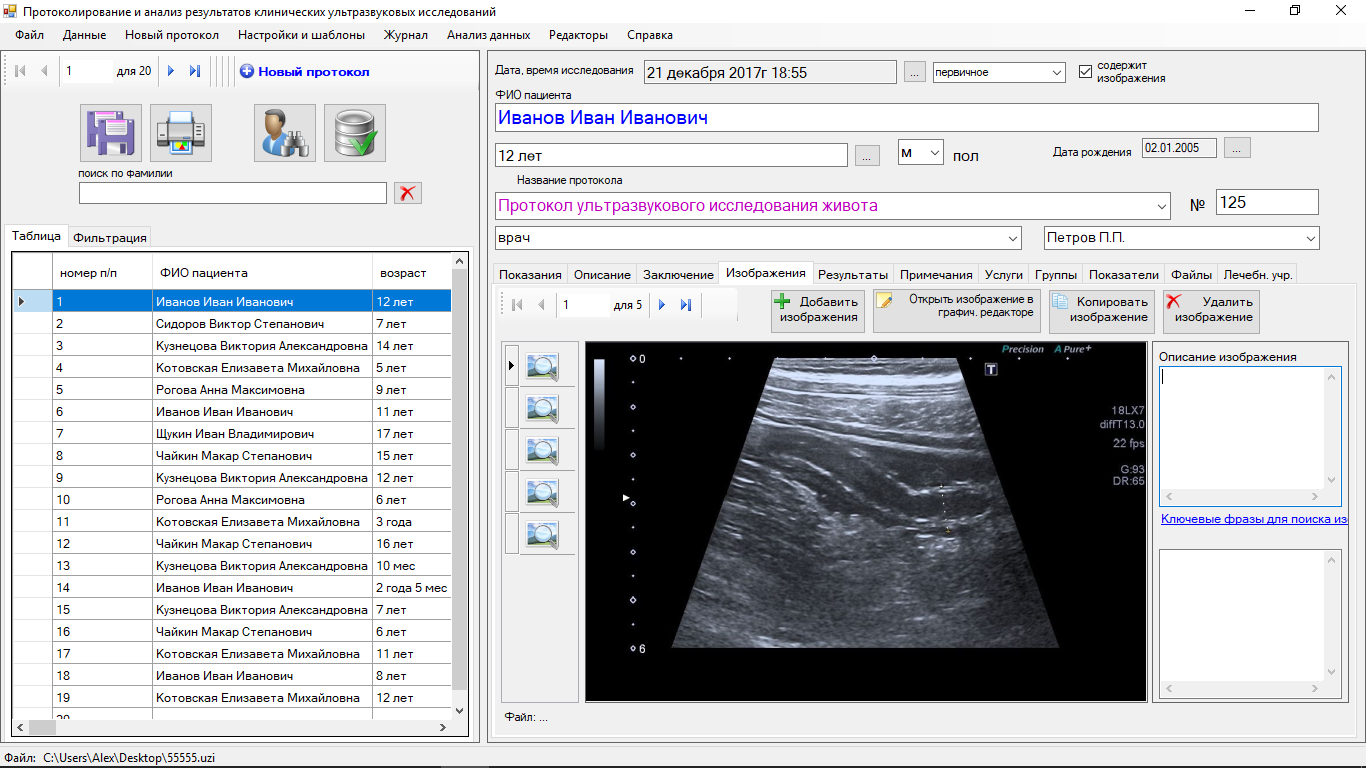 Программа для УЗИ протокола бесплатно. УЗИ полового члена протокол УЗИ. Программное обеспечение УЗИ. Интерфейс УЗИ.