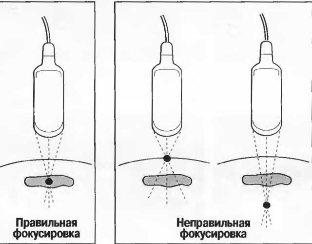 Глубина Влагалища