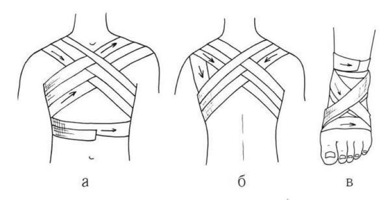 Крестообразная повязка. Восьмиобразная или крестообразная повязка. Крестообразная (восьмиобразная) повязка. Крестообразная (восьмиобразная) перевязка. Крестообразная повязка техника наложения.