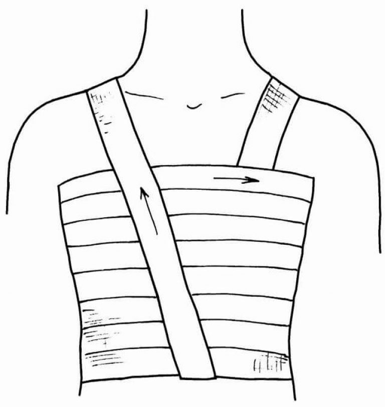 Повязка на молочную железу. Наложение спиральной повязки на грудную клетку. Техника наложения спиральной повязки на грудную клетку. Десмургия спиральная повязка на грудную клетку. Методика наложения спиралевидной повязки..
